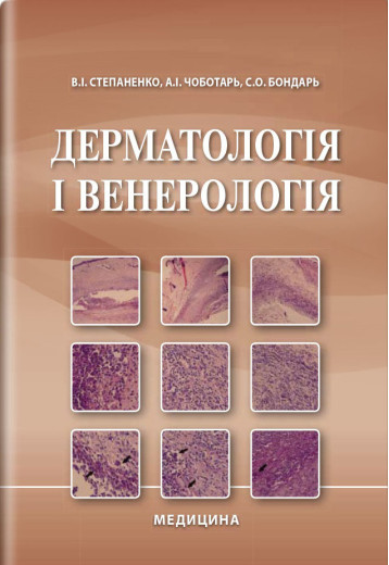 Дерматологія і венерологія: підручник / В. І. Степаненко, А. І. Чоботарь, С. О. Бондар та ін. — 2-е видання