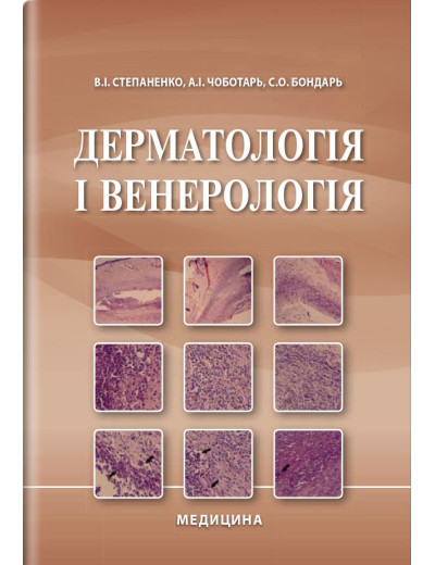 Дерматологія і венерологія: підручник / В. І. Степаненко, А. І. Чоботарь, С. О. Бондар та ін. — 2-е видання Дерматологія і венерологія: підручник / В. І. Степаненко, А. І. Чоботарь, С. О. Бондар та ін. — 2-е видання