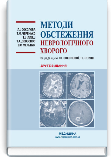 Методи обстеження неврологічного хворого: навчальний посібник. Л. І. Соколова, Т. М. Черенько, Т. І. Ілляш та Методи обстеження неврологічного хворого: навчальний посібник. Л. І. Соколова, Т. М. Черенько, Т. І. Ілляш та