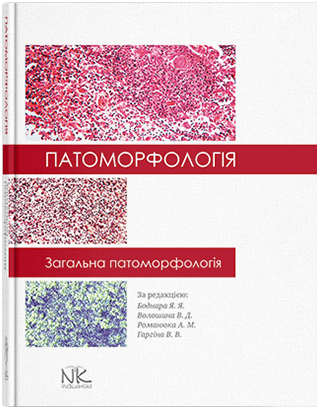 Патоморфологія. Загальна патоморфологія. Боднар Я. Я. та ін. Патоморфологія. Загальна патоморфологія. Боднар Я. Я. та ін.