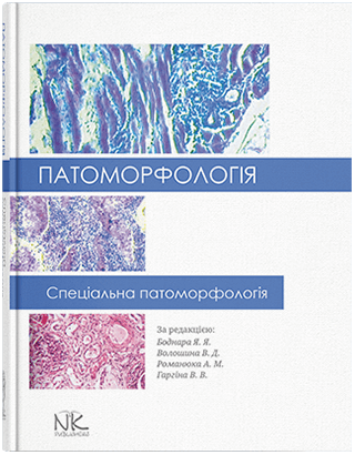 Патоморфологія. Спеціальна патоморфологія. Боднар Я. Я., Волошина В. Д., Романюк А. М., Гаргіна В. В. Патоморфологія. Спеціальна патоморфологія. Боднар Я. Я., Волошина В. Д., Романюк А. М., Гаргіна В. В.
