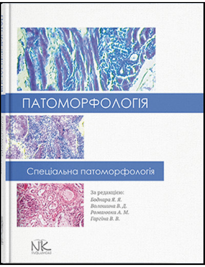 Патоморфологія. Спеціальна патоморфологія. Боднар Я. Я., Волошина В. Д., Романюк А. М., Гаргіна В. В. Патоморфологія. Спеціальна патоморфологія. Боднар Я. Я., Волошина В. Д., Романюк А. М., Гаргіна В. В.
