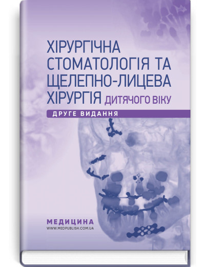 Хірургічна стоматологія та щелепно-лицева хірургія дитячого віку: підручник. Л.М. Яковенко, В.Г. Черкасов, І. Хірургічна стоматологія та щелепно-лицева хірургія дитячого віку: підручник. Л.М. Яковенко, В.Г. Черкасов, І.