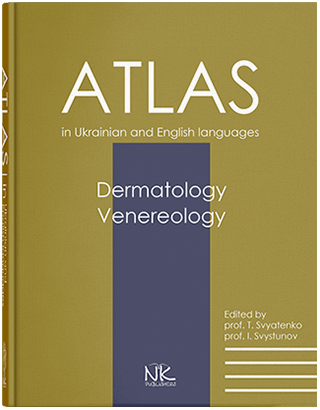 Дерматологія. Венерологія . Dermatology. Venereology : атлас укр. та англ. мовами. Святенко Т.В., Свистунів.