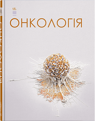 Онкологія. Шевченко А. І. та ін. Онкологія. Шевченко А. І. та ін.
