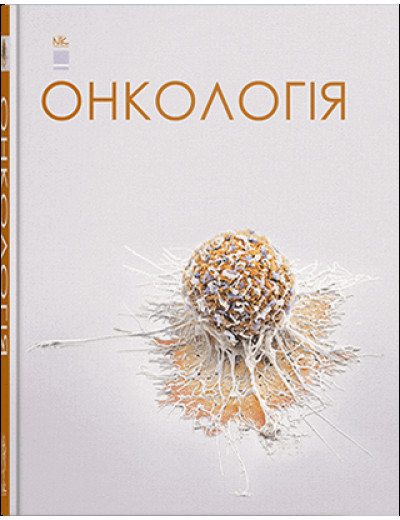 Онкологія. Шевченко А. І. та ін. Онкологія. Шевченко А. І. та ін.