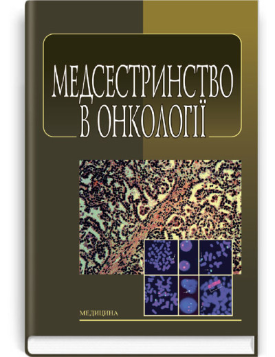 Медсестринство в онкології: підручник (ВНЗ І—ІІІ р. а.). Л.М. Ковальчук, О.М. Парійчук, І.І. Романишин та ін. Медсестринство в онкології: підручник (ВНЗ І—ІІІ р. а.). Л.М. Ковальчук, О.М. Парійчук, І.І. Романишин та ін.