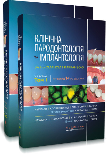 Клінічна пародонтологія та імплантологія за Ньюманом і Карранзою: 14-е видання: в 2-х томах .Майкл Г. Ньюман,