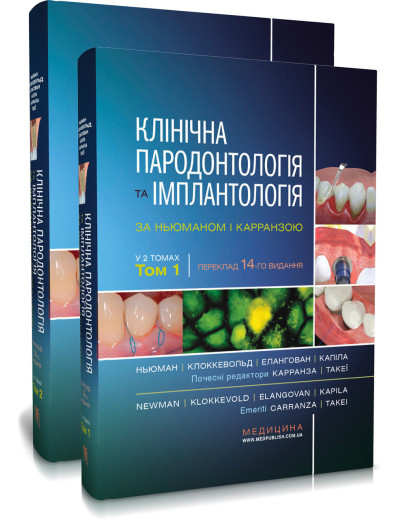 Клінічна пародонтологія та імплантологія за Ньюманом і Карранзою: 14-е видання: в 2-х томах .Майкл Г. Ньюман, Клінічна пародонтологія та імплантологія за Ньюманом і Карранзою: 14-е видання: в 2-х томах .Майкл Г. Ньюман,
