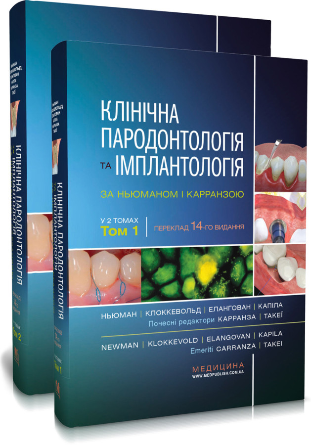 Клінічна пародонтологія та імплантологія за Ньюманом і Карранзою: 14-е видання: в 2-х томах .Майкл Г. Ньюман,
